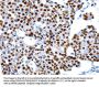 HDAC2 Antibody