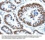 HDAC2 Antibody