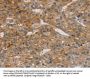TM4SF1 Antibody
