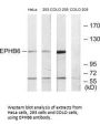 EPHB6 Antibody