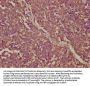 ORM1 Antibody