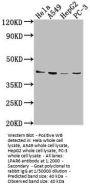 LPAR6 Antibody