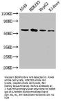 P4HA1 Antibody