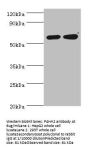 P4HA2 Antibody