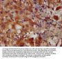 PACS2 Antibody