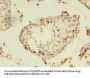 PANK1 Antibody