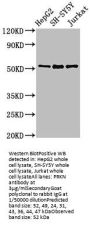 PRKN Antibody