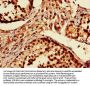 PRKN Antibody
