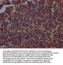 PARP1 Antibody