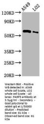 PARP3 Antibody