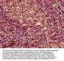 PARP3 Antibody