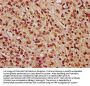 PARP3 Antibody