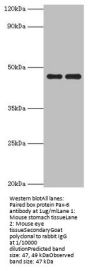 PAX6 Antibody