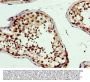 PBX1 Antibody