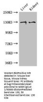 PC Antibody