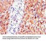PC Antibody