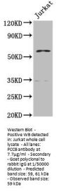 PCCB Antibody