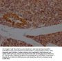 PCNT Antibody