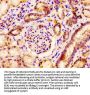 PCSK6 Antibody
