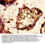 PCSK6 Antibody