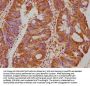 PCSK9 Antibody