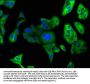 PCSK9 Antibody
