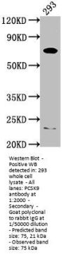 PCSK9 Antibody