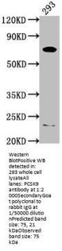 PCSK9 Antibody