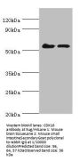 CDK16 Antibody