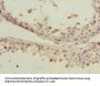 PDCD5 Antibody