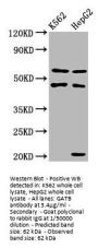 GATB Antibody