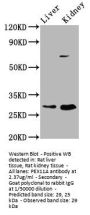 PEX11A Antibody