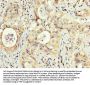 PEX5 Antibody