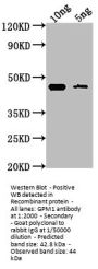 GPM1 Antibody