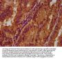 PGLYRP1 Antibody