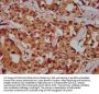 PGLYRP1 Antibody