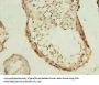PHF10 Antibody