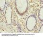 PHF10 Antibody