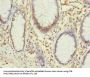 PHF10 Antibody