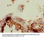 PHF11 Antibody