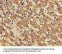 PHF21A Antibody