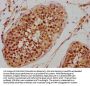 PHF7 Antibody