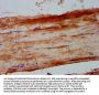 PHKA1 Antibody