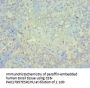 PIAS1 Antibody