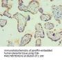 PIAS1 Antibody