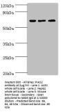 PIAS2 Antibody