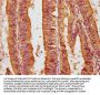 PIGN Antibody