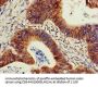 PIK3R2 Antibody