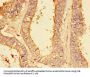 PLA2G4A Antibody