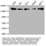PLXNB2 Antibody